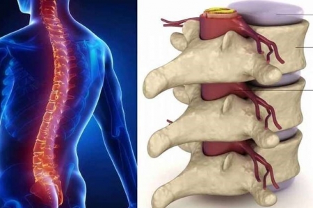 Nhận biết sớm thoái hóa, thoát vị và chèn ép thần kinh